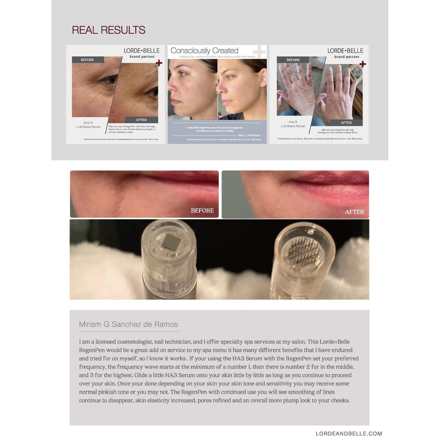 Lorde + Belle RegenPen™ Skincare Device Kit