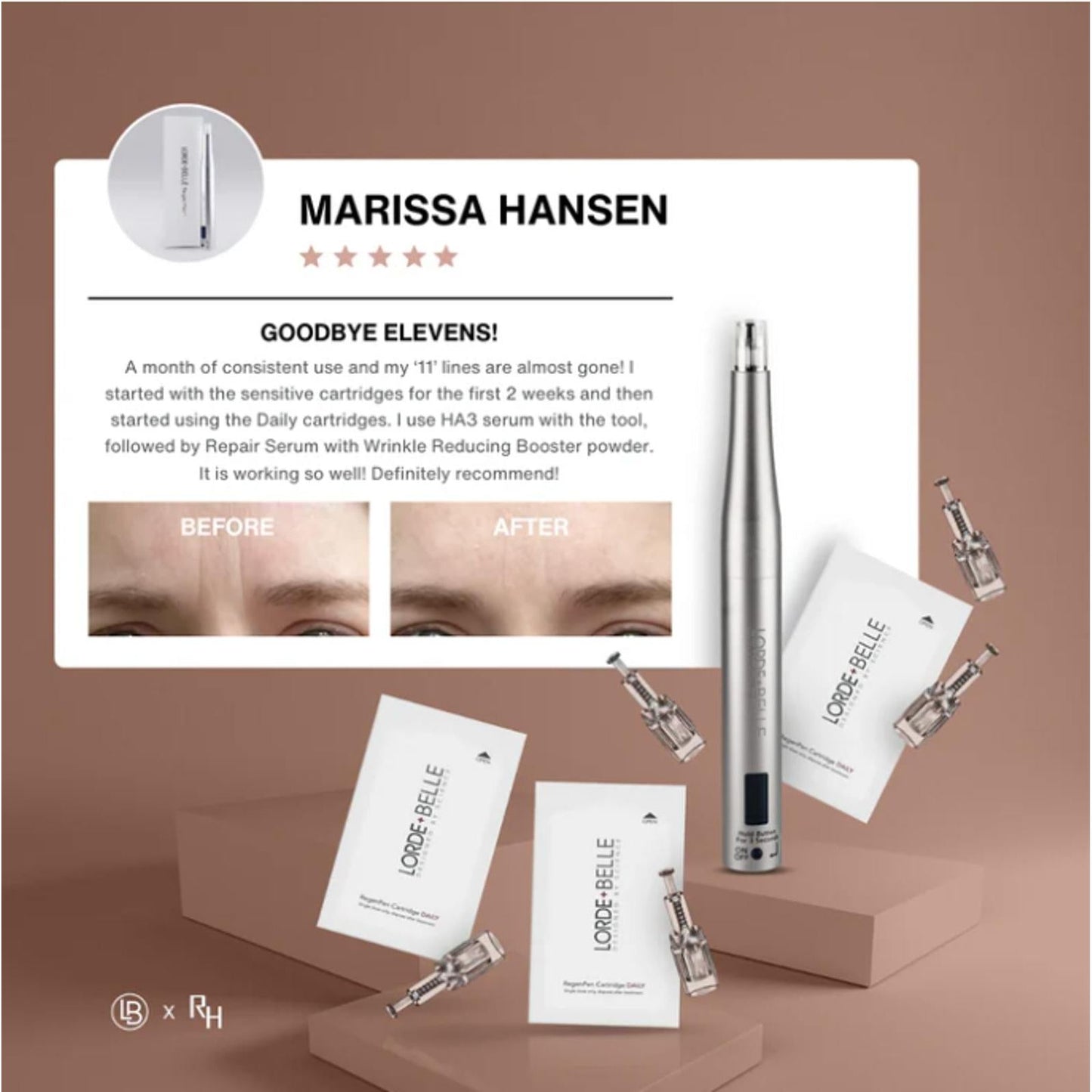 LORDE + Belle ReGenPen™ Skin Care Tool - Transform Your Skin